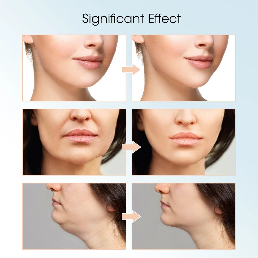 Photonentherapie Hautverjüngung Slim Facial Massager